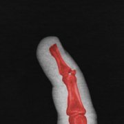 Молодые Люди Пройдемте - Больно