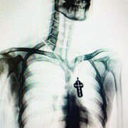 Крест - РЕНТГЕН